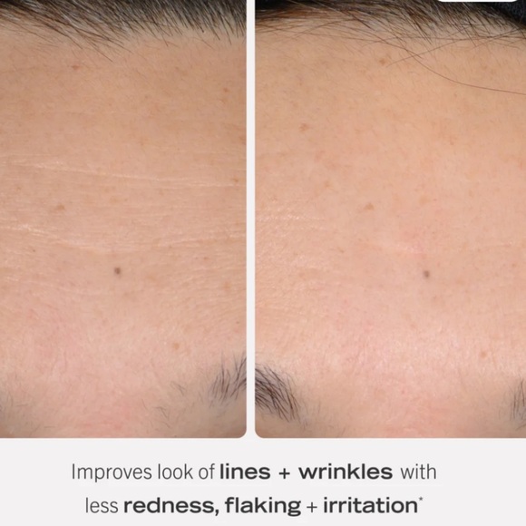 NIB•First Aid Beauty 0.3% Retinol Complex Serum With Peptides - Picture 2 of 4